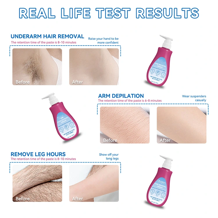 Cream To Stop Hair Growth On Face